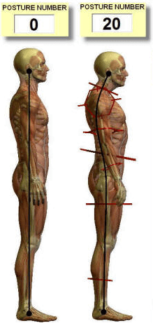 Posture - PosturePro - example of Posture Number
PosturePro, P., (2021) Posture number. [ONLINE]. Available at: https://posturepro.com/ [Accessed 14 January 2021].