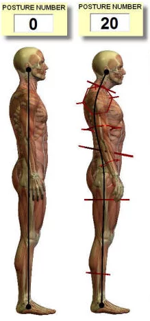 Posture - PosturePro - example of Posture Number
PosturePro, P., (2021) Posture number. [ONLINE]. Available at: https://posturepro.com/ [Accessed 14 January 2021].